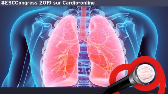 Recommandation ESC 2019 : Embolie pulmonaire