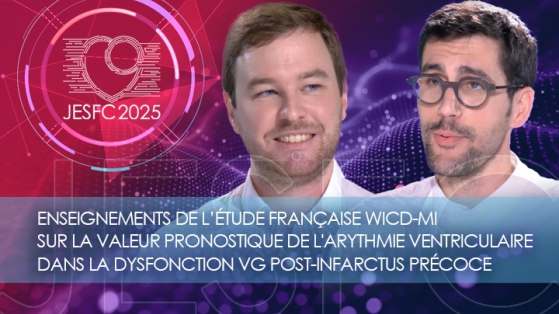 Enseignements de l’étude française WICD-MI sur la valeur pronostique de l'arythmie ventriculaire dans la dysfonction VG post-infarctus précoce