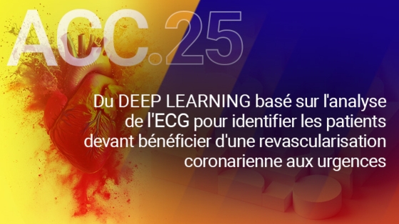 Bons résultats d'une analyse ECG pour identifier les patients ayant besoin d’une revascularisation coronarienne ou avec un infarctus de type 1 aux urgences.