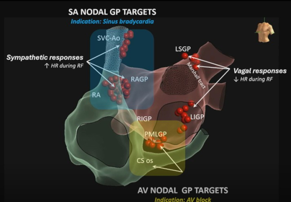 SA NODAL GP TARGETS