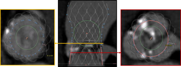 Simulation de l&rsquo;implantation de l&rsquo;Evolut 29