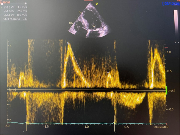 Paramètres échographiques