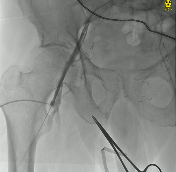 Jena-is-the-Heart&rsquo;s-Mate-figure9.2.jpg