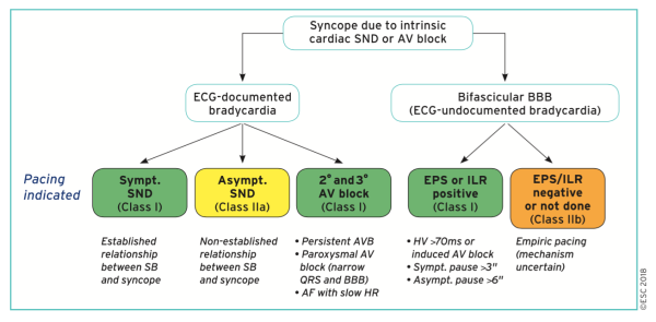 Schéma du traitement des causes cardiaques de la syncope (ESC 2018)