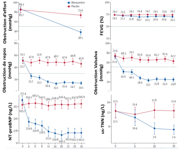 Efficacité / tolérance de Mavacamten (en rouge vs. placebo en bleu)
