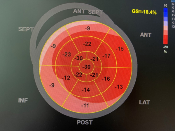 Paramètres échographiques