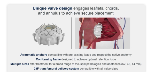 TRISCEND : Remplacement de valve tricuspide percutané, une nouvelle piste !