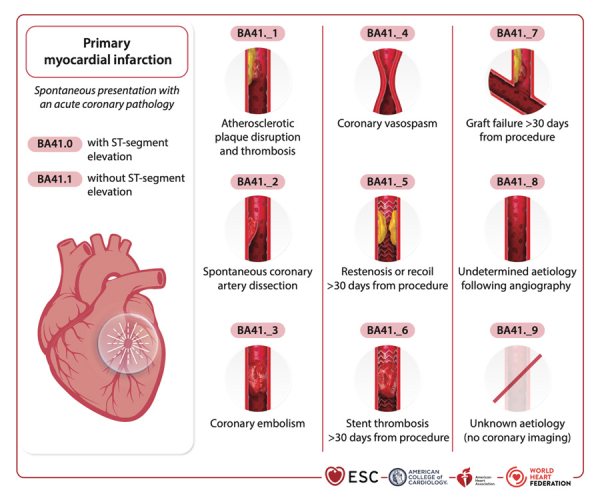 reco-infarctus-figure-2-infarctus-du-myocarde-primaire.jpg