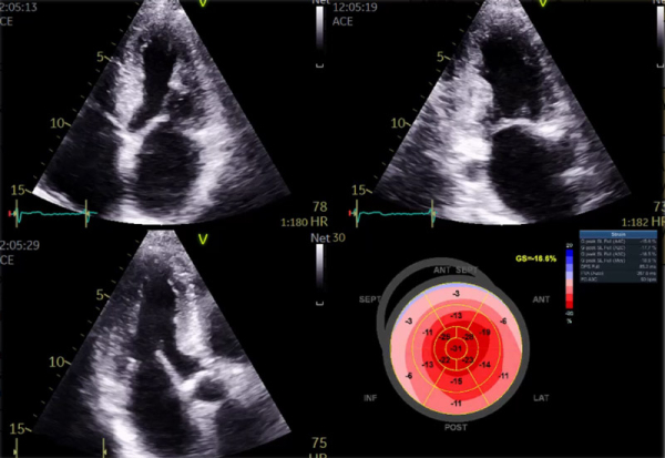European Heart Journal (2021) 42, 1554–1568