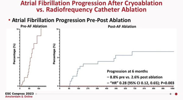 Figure 3. Progression vers la FA persistante avant et après l’ablation.