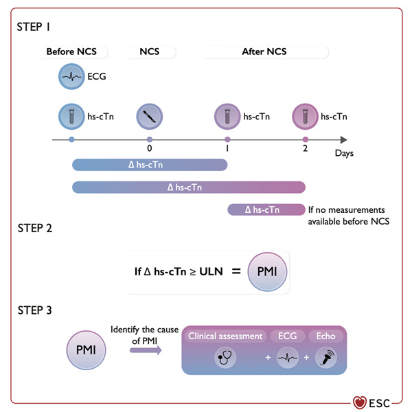 Figure 13. Complications cardiovasculaires péri-opératoires