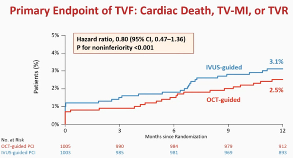 Figure 1. Courbes de Kaplan Meier du critère de jugement principal (composite de la mortalité cardiovasculaire, infarctus du myocarde attribuable au vaisseau cible, ischémie résiduelle du vaisseau cible nécessitant une revascularisation complémentaire) dans les deux groupes.