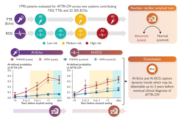 R&eacute;sum&eacute; de l&rsquo;&eacute;tude &laquo; Artificial intelligence-enabled electrocardiography and echocardiography to track preclinical progression of transthyretin amyloid cardiomyopathy