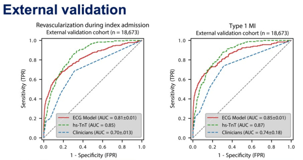 Performance du modèle dans la cohorte de validation externe