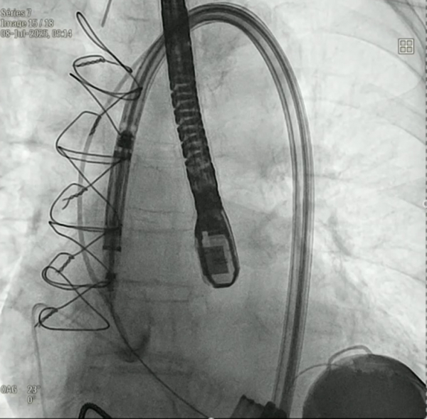 Jena-is-the-Heart&rsquo;s-Mate-figure11.jpg