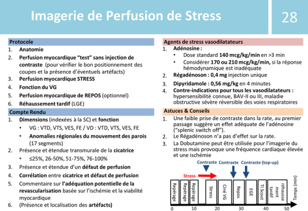 Imagerie de Perfusion de Stress - Protocole - Compte Rendu - Agents de stress - Astuces & Conseils