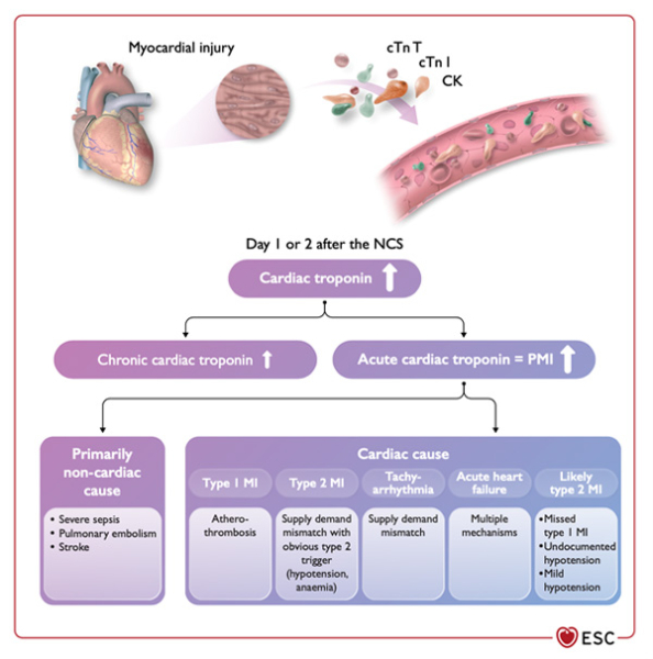 Figure 11. Complications cardiovasculaires péri-opératoires