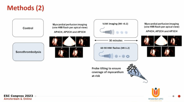 Figure 1 : Méthodologie de l'étude MRUSMI