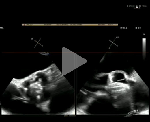 Jena-is-the-Heart&rsquo;s-Mate-video5-img