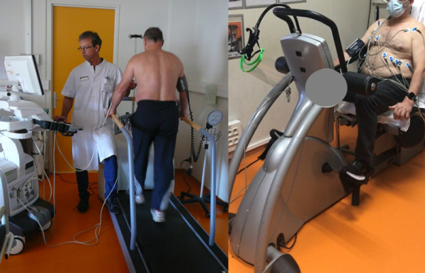 Figure 2 : Réalisation de l’échocardiographie d’effort dans la position la plus verticale possible : sur tapis (à droite), sur cycloergonomètre (vélo) en position assise et peu inclinée (à gauche)