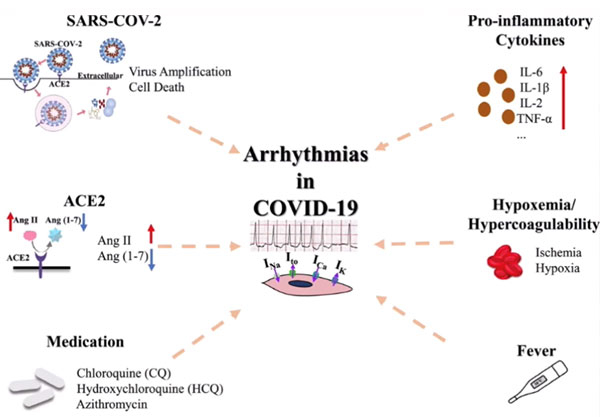 COVID-19 chez les enfants et rôle de l’imagerie cardiaque