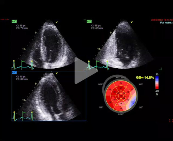 Syndrome_oedémateux_video7_img