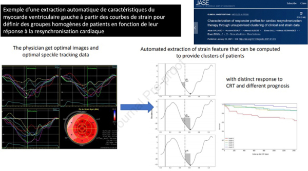 Innovations et perspectives futures de l’intelligence artificielle appliquée à l’échocardiographie - Figure 2