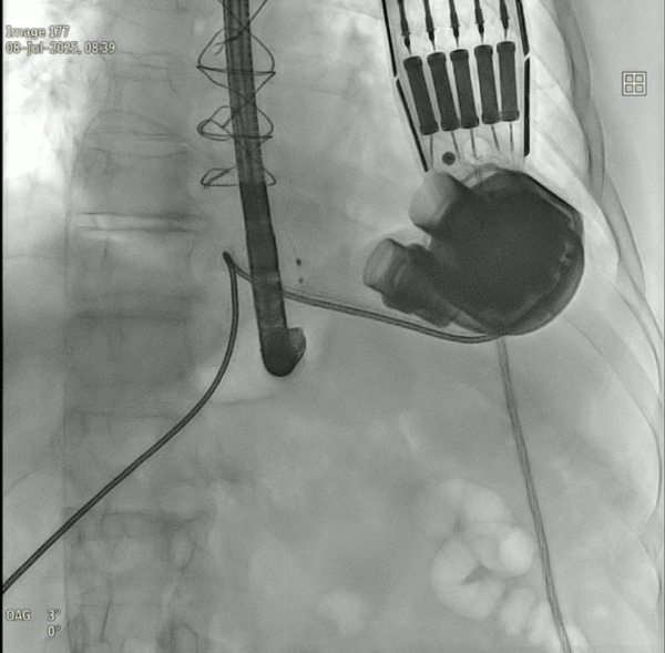 Jena-is-the-Heart&rsquo;s-Mate-figure7.jpg
