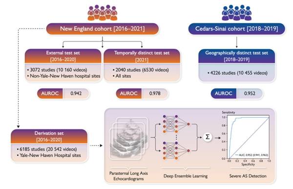 R&eacute;sum&eacute; de l&rsquo;&eacute;tude &laquo; Severe aortic stenosis detection by deep learning applied to echocardiography