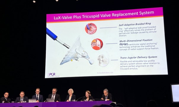 Photographie de la présentation lors du PCR London Valve 