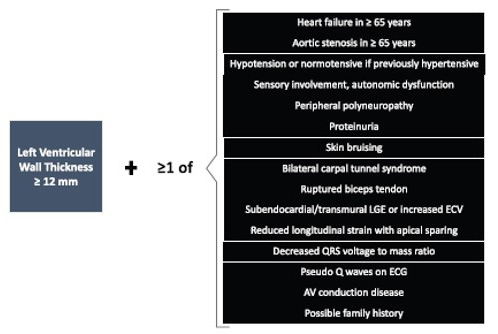 Evoquer une amylose cardiaque devant toute HVG ⩾ 12mm + « red flags »