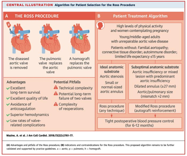 Illustration centrale Algorithm for Patient Selection for the Ross Procedure