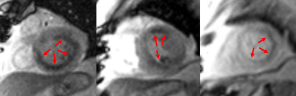 Figure 6 : Séquence de perfusion premier-passage au stress