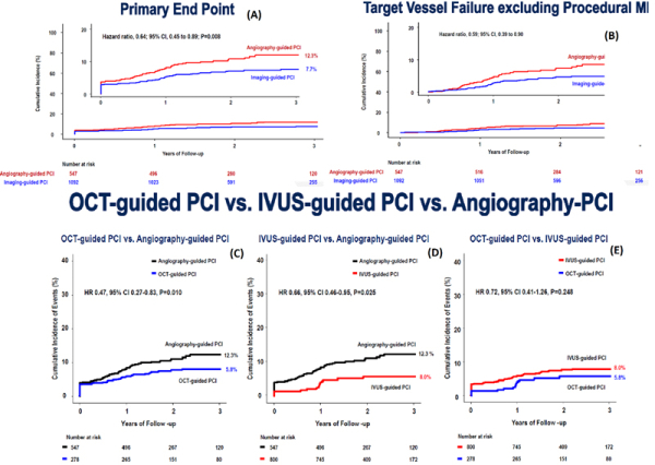 Figure 1 : Résultats principal et secondaires de RENOVATE-COMPLEX-PCI (A) Résultat principal sur le composite mortalité cardiovasculaire ou IDM secondaire une lésion cible ou revascularisation d’une lésion cible (B) Analyse du critère de jugement principal après exclusion des IDM péri-procéduraux (C) Stratégie guidée par l’OCT vs angiographie (D) Stratégie guidée par IVUS vs angiographie (E) Stratégie guidée par l’OCT vs IVUS.