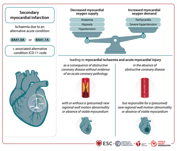 reco-infarctus-figure-3-infarctus-du-myocarde-secondaire.jpg