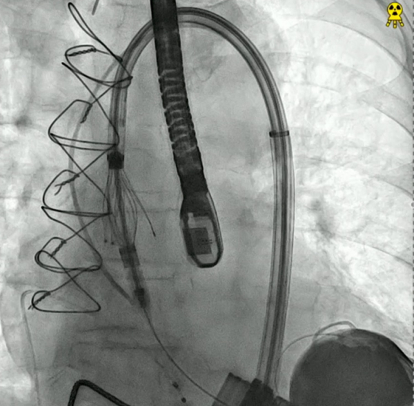 Jena-is-the-Heart&rsquo;s-Mate-figure12.jpg