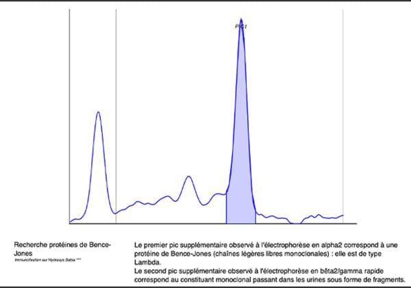 Bilan biologique