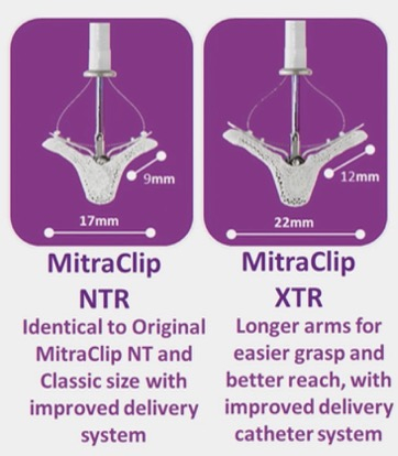 Systèmes MitraClip NTR et XTR