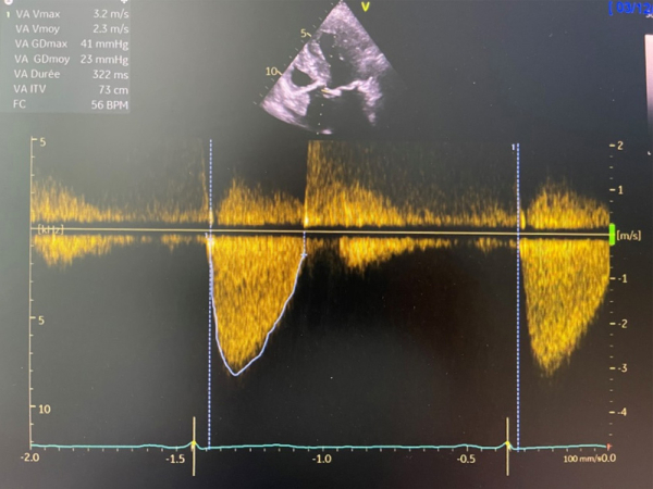 Paramètres échographiques