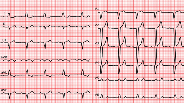 Jena-is-the-Heart&rsquo;s-Mate-figure1.jpg
