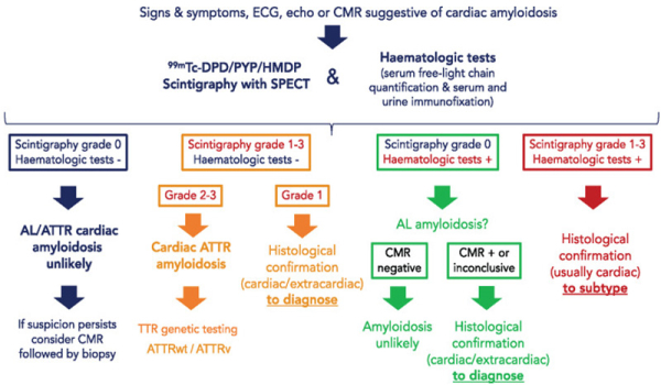 Figure 4 : Algorithme diagnostique en cas de suspicion d’amylose cardiaque. D’après Garcia-Pavia P. et al European Journal of Heart failure 2021 : ESC position paper.