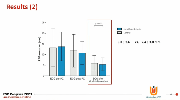 Figure 2 : Résultats sur le critère de jugement principal (mesure du sus-décalage du segment ST post-angioplastie) 