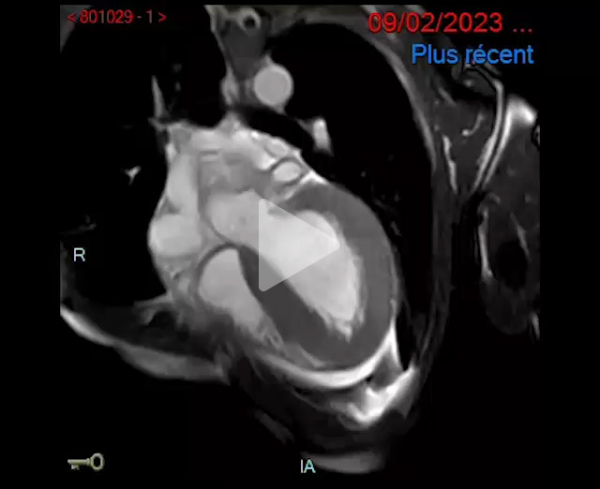 Syndrome_oedémateux_video4_img