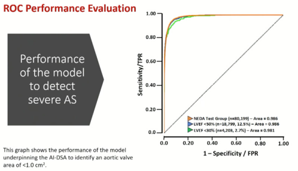 Figure 2 : Courbe ROC de l’algorithme d’IA pour détecter un rétrécissement aortique