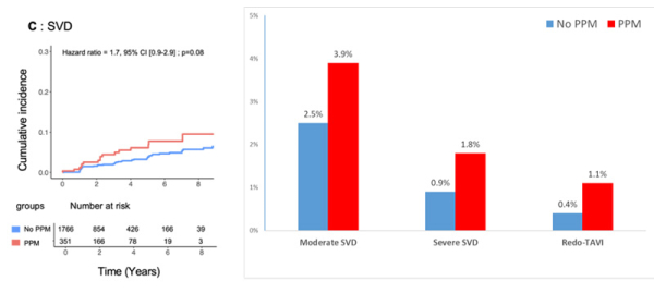 Figure 4 : Effet du PPM sur la survenue de détérioration structurelle de valve (SVD)