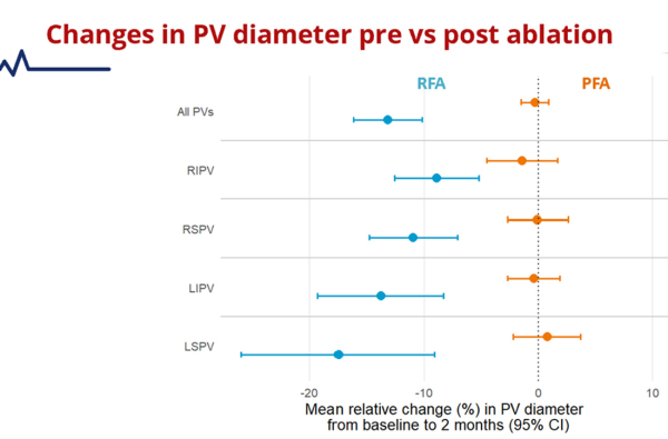 Change in PV diameter pre vs post ablation