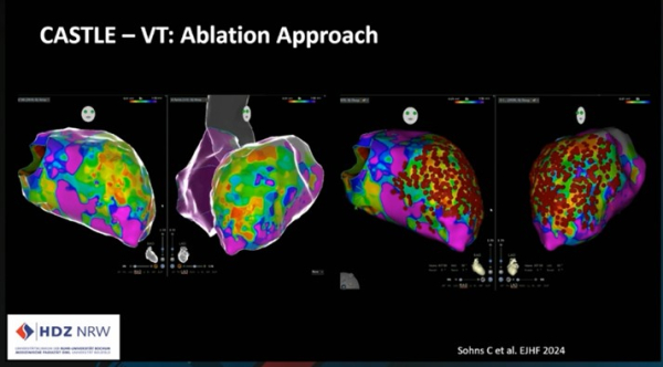 CASTEL-VT: Ablation Approach