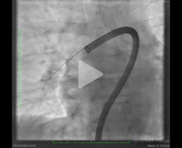 un-infarctus-mais-pas-du-myocarde-vidéo3-img