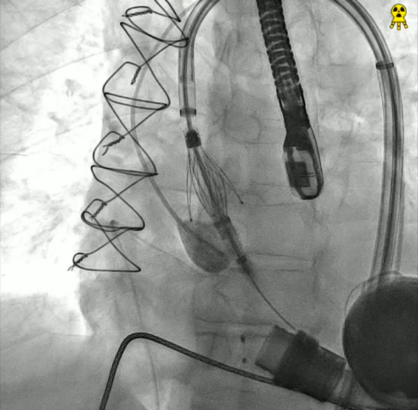 Jena-is-the-Heart&rsquo;s-Mate-figure13.jpg
