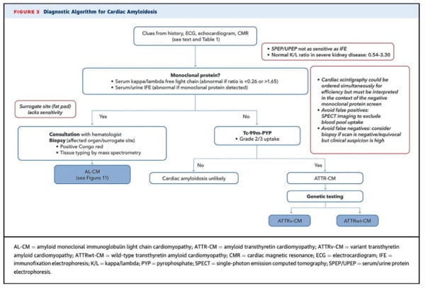 Diagnostic alogorithm for Cardiac Amyloidosis